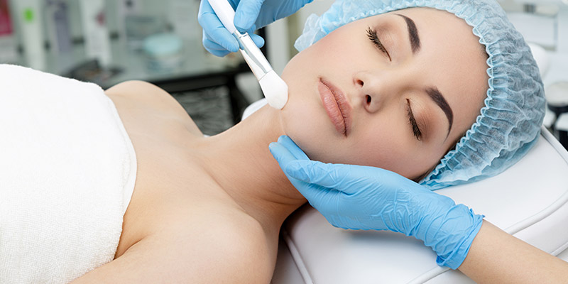 peeling químico facial