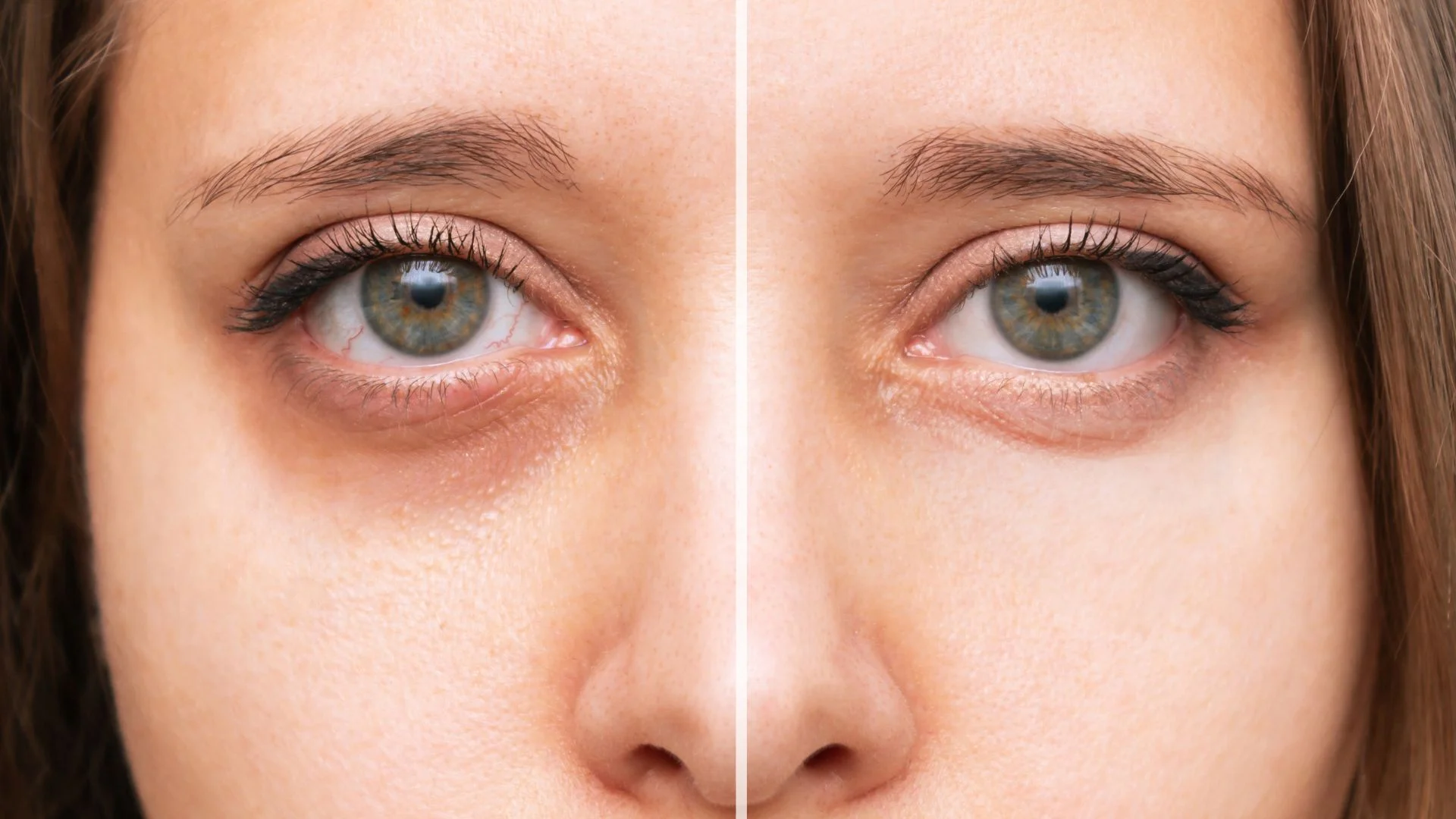 Ilumina tu mirada con el relleno de ojeras.